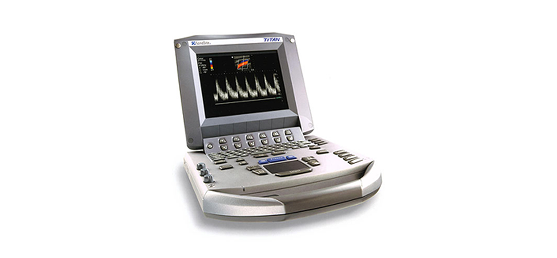 Sonosite-Titan-Portable-Ultrasound.png