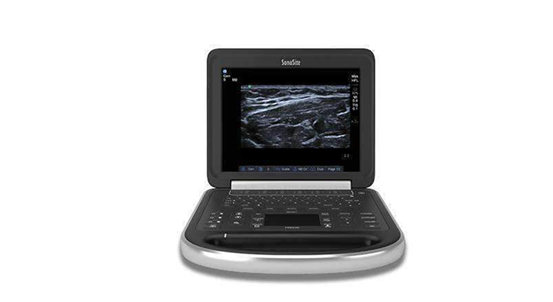 Sonosite-Edge-Portable-Ultrasound-(1).png