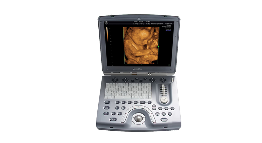 GE-Voluson-e-Portable-Ultrasound.png