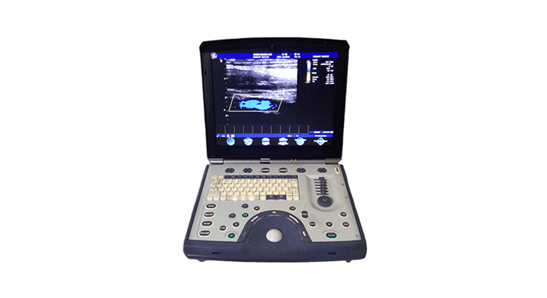 GE-Vivid-i-Portable-Ultrasound.png