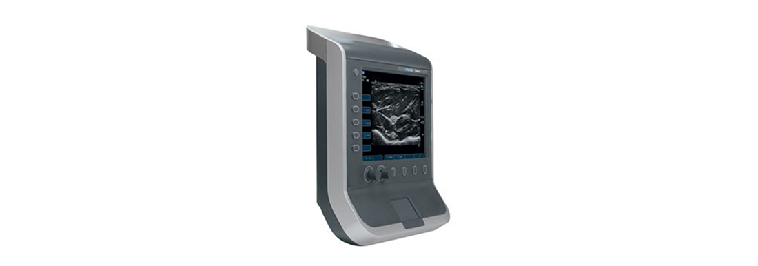 Sonosite-S-Cath-Portable-Ultrasound-(2).png Sonosite-S-Cath-Portable-Ultrasound-(2).png