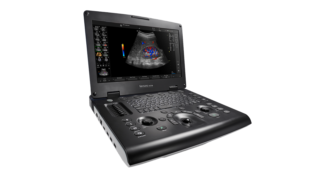 GE-Versana-Active-Ultrasound-(1).png