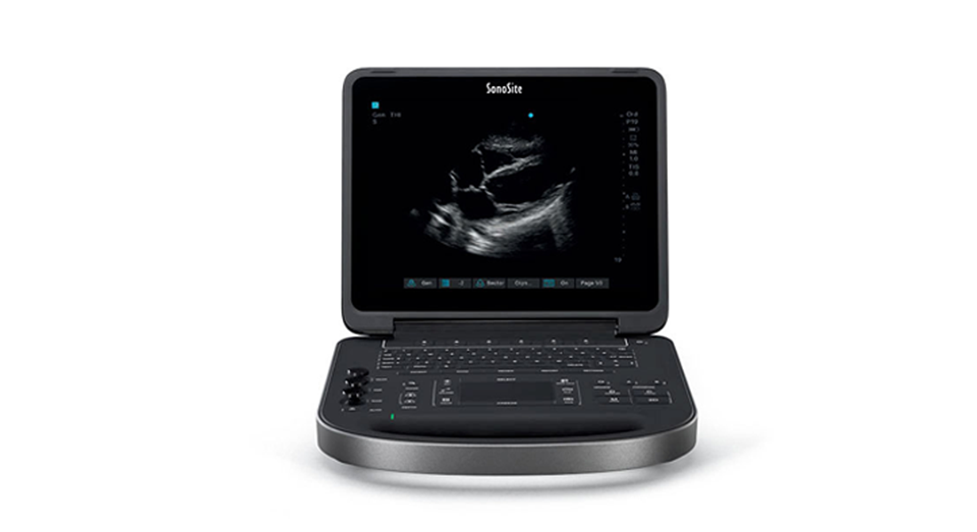 Sonosite-Edge-II-Portable-Ultrasound.png