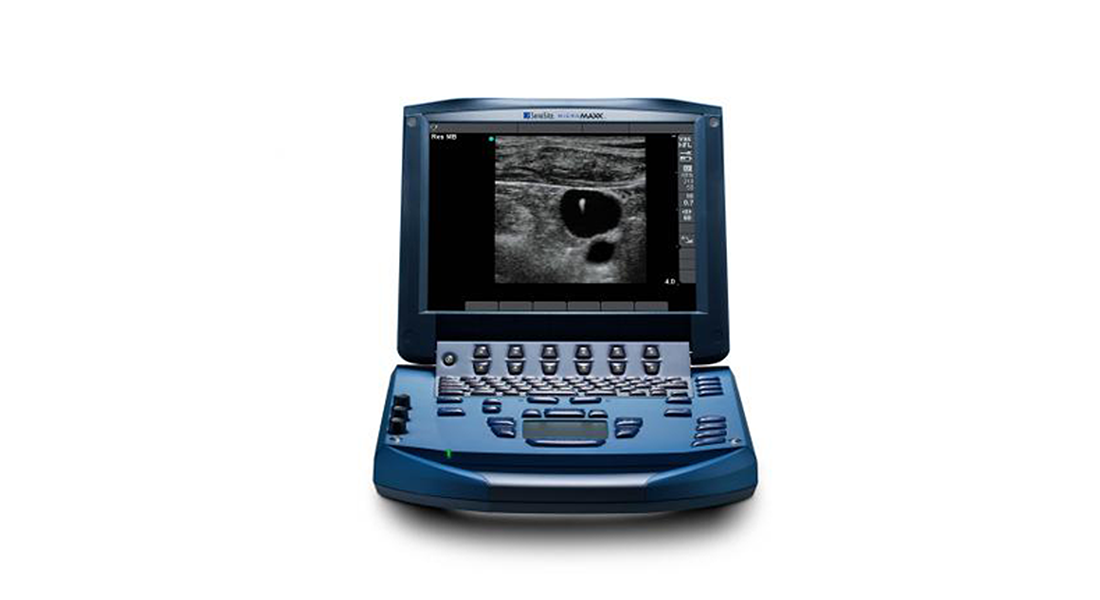 Sonosite-MicroMaxx-Portable-Ultrasound.png