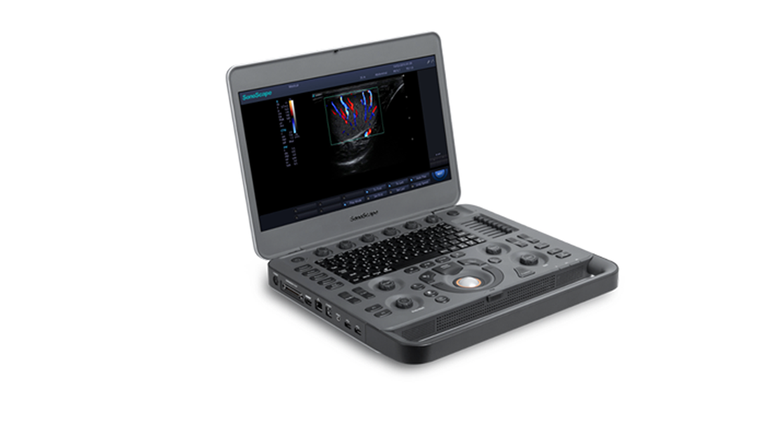 Sonoscape-X5-Portable-Ultrasound.png