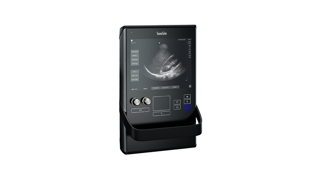 Sonosite-SII-Portable-Ultrasound.png