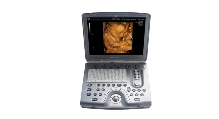 GE Voluson Portable Ultrasound Machine