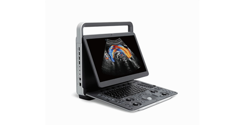 SonoScape Portable Ultrasound Machine