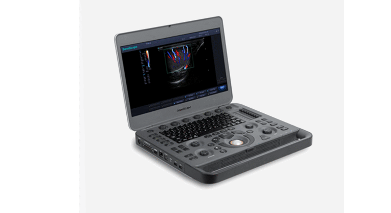 SonoScape X Portable Ultrasound Machine