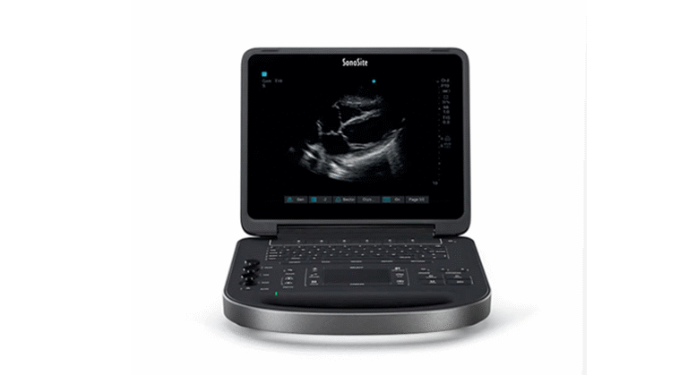 Sonosite Edge II Portable Ultrasound Machine