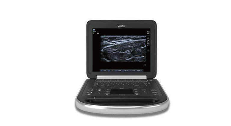 Sonosite Edge Portable Ultrasound Machine