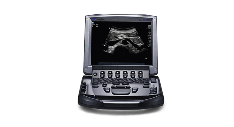 Sonosite M Turbo Portable Ultrasound Machine