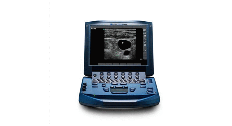 Sonosite MicroMaxx Portable Ultrasound Machine