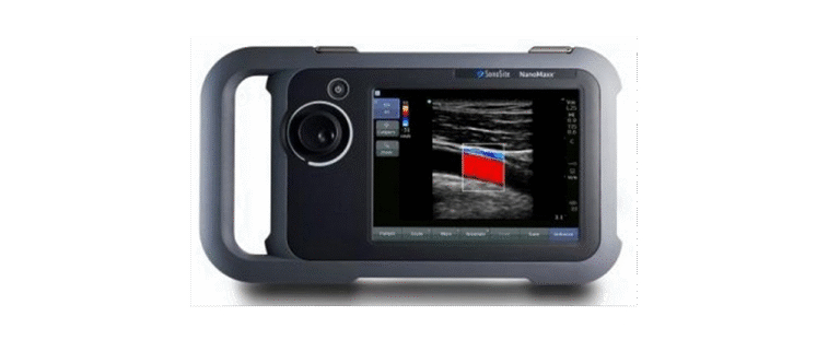Sonosite NanoMaxx Portable Ultrasound Machine