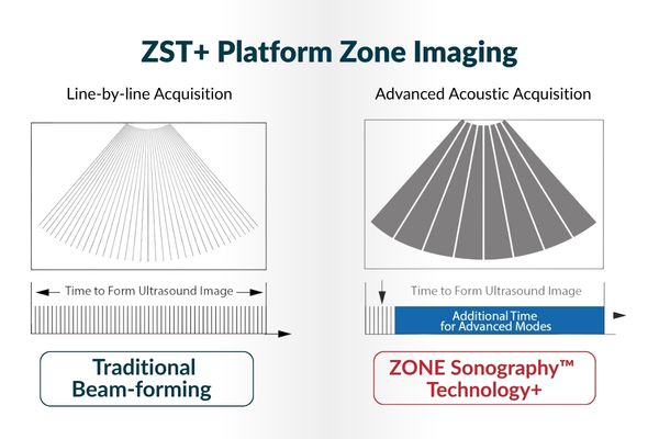 Mindray ZST+ platform ZST+ platform