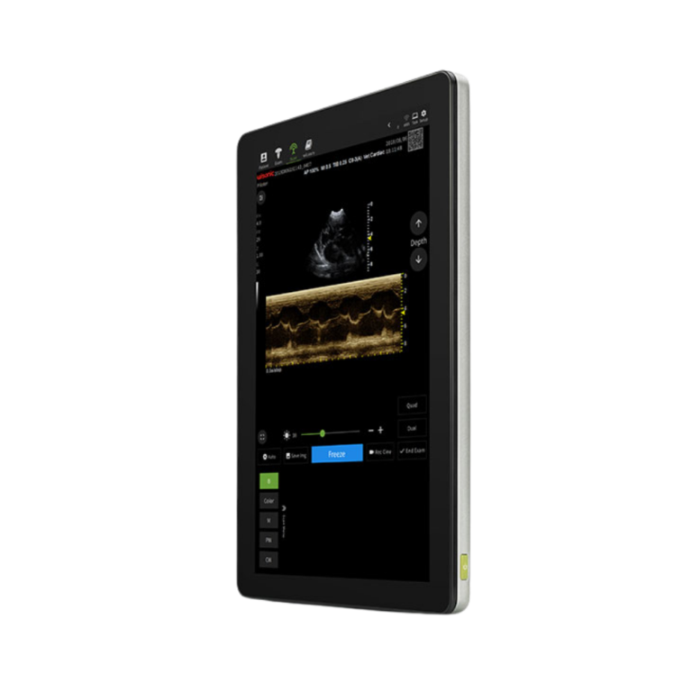 wisonic-piloter-tablet-ultrasound-machine